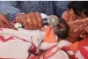 मनोज जरांगेंनी पाणी अन् सलाईन सोडले! आंदोलनाचा आज नववा दिवस