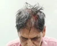 भरदिवसा मॉर्निंग वॉक करणाऱ्या 68 वर्षीय व्यक्ती वर प्राणघातक हल्ला..!