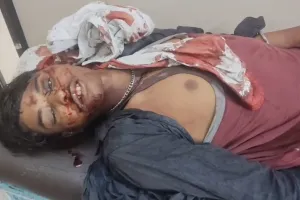 वाघलवाडा येथे नविन साखर खाण्यावर बाल कामगाराचा  खांबावरून पडून जागीच मृत्यू 